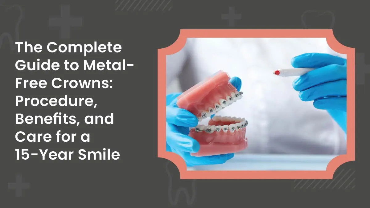 Metal-Free Crowns: Procedure, Benefits & Care Guide